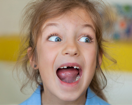 Child opening their mouth wide to reveal several missing teeth